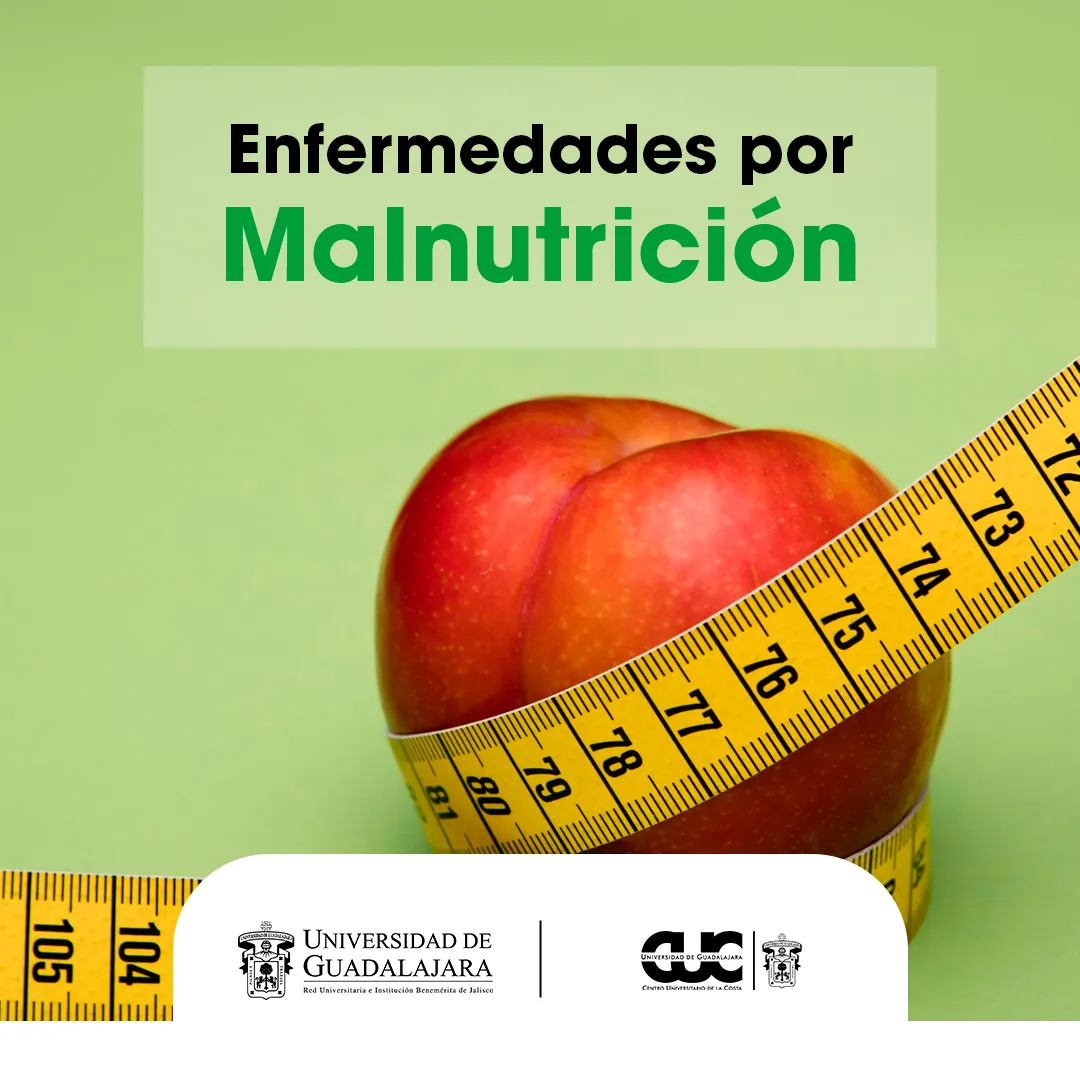 malnutrición